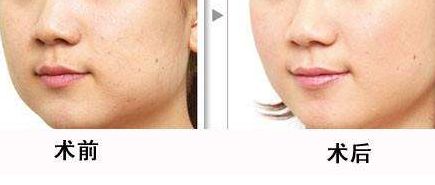 北京清華長(zhǎng)庚醫(yī)院為何不列入三甲？整形技術(shù)如何？名醫(yī)推薦給你