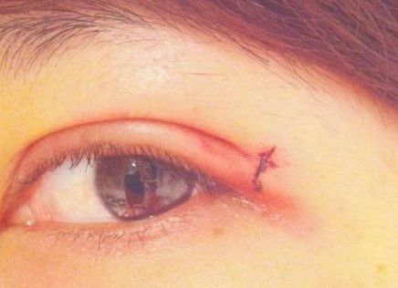 南寧受追捧的整形醫(yī)院，魅力明星推薦，獨特亮點閃耀