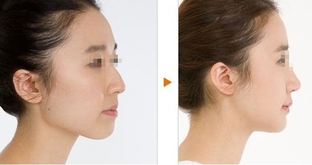 沈陽隆胸整形哪家醫(yī)院技術(shù)領(lǐng)先？頭部醫(yī)療機(jī)構(gòu)推崇，專業(yè)醫(yī)生幫您圓夢(mèng)