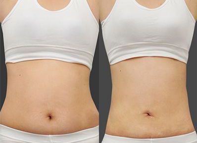 智慧選擇，打造肌膚零瑕疵！廣東祛斑醫(yī)院大比拼，真實(shí)實(shí)力PK！