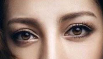 濟南省立醫(yī)院面部吸脂真的靠譜嗎？2023手術(shù)恢復過程有親身經(jīng)歷的人嗎？