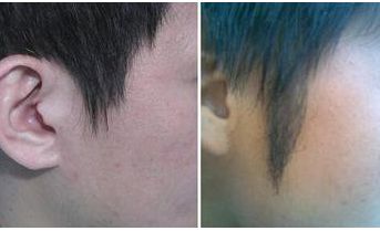 西安著名拉皮手術(shù)醫(yī)生推薦！專家團(tuán)隊(duì)不俗技藝，魯禮新、楊萬忠亮相