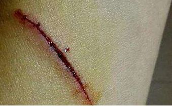 北京祛斑兩全皆美，這些醫(yī)院實力收割好評！