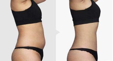 沈陽國防醫(yī)院簡介：為什么選擇沈陽國防醫(yī)院進(jìn)行醫(yī)美整形？