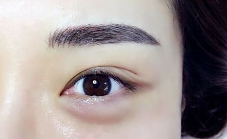 重慶杰出眼科專家范文亮醫(yī)生：醫(yī)術(shù)高超，多個成功案例揭秘