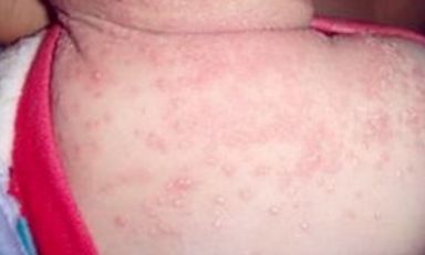 蘇州維多利亞美容醫(yī)院：醫(yī)生團(tuán)隊(duì)實(shí)力如何？案例果效反饋醫(yī)生信息匯總