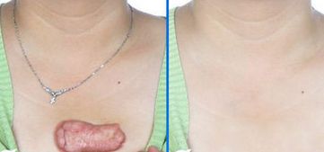 南京施爾美孫欣醫(yī)生 眼睛疾病治療90天真實案例分享