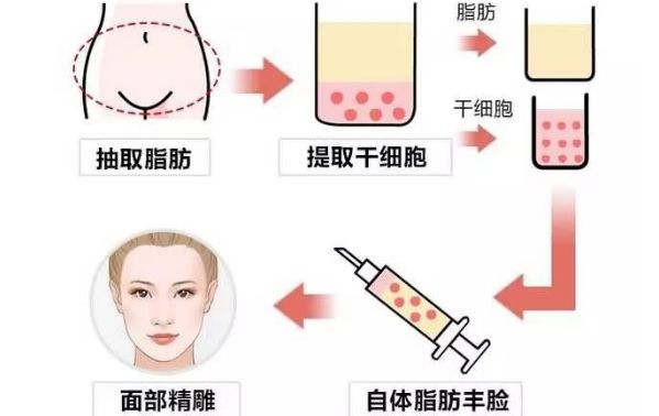 從醫(yī)生個(gè)人資料到豐胸案例圖對(duì)比，揭秘王沛森的豐胸效果！