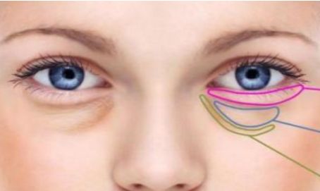 杭州哪家醫(yī)院口碑不錯，面部提升效果棒棒的