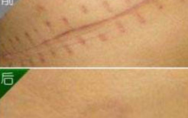 北京非常受歡迎的鼻部整形醫(yī)生，排名一覽！