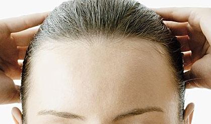 郭建玲雙眼皮修復費用揭秘！看真實案例圖分享，了解其技術(shù)效果！