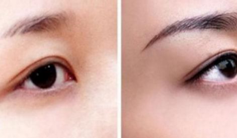 新一期海南隆鼻醫(yī)院名單來啦！維多利亞實力引領(lǐng)口碑榜！