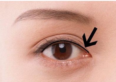 南京胸部整形醫(yī)生吳國平的最新成功案例！