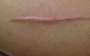 成都比較受推薦的磨骨醫(yī)生排行榜：前十強名單公布！