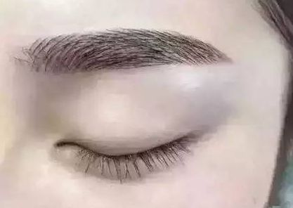 寧波美容整形醫(yī)院有哪些值得關(guān)注？這幾家醫(yī)院的口碑如何？