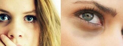 廈門碧蓮盛植發(fā)醫(yī)院效果如何？安全可靠嗎？