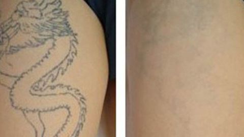 2023年鄭州整形醫(yī)院最新推薦！天后、華領(lǐng)、美萊等全面介紹！