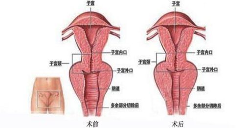 上海九院哪里能夠得到專業(yè)的隆鼻手術(shù)？排行榜最新推薦五位頂尖隆鼻專家