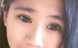 羅飛彪醫(yī)生開(kāi)展的鼻子整形手術(shù)，售價(jià)一覽表，各種風(fēng)格任你挑選！