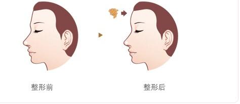 綿陽碧蓮盛植發(fā)醫(yī)院的效果如何？如何查詢地址及醫(yī)生信息？