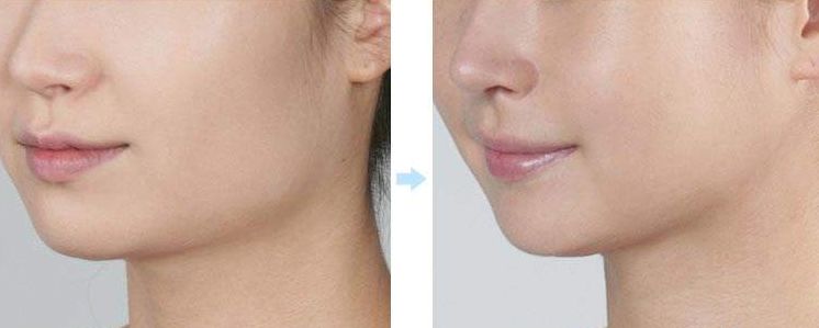 成都整形醫(yī)院揭曉：這五家醫(yī)院獲得排名前列！