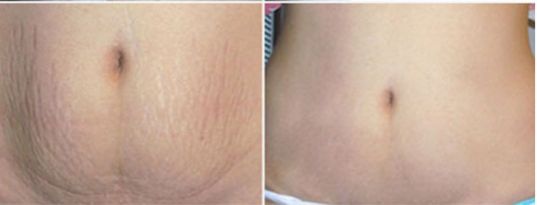 多位知名醫(yī)生修復(fù)雙眼皮技術(shù)對(duì)比，王太玲和盧建建誰更出眾？立體醫(yī)學(xué)美容室推薦名醫(yī)修復(fù)雙眼皮解析及價(jià)格大