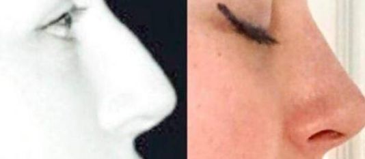 杭州整容醫(yī)生：陳小平、曾海峰長(zhǎng)期位居榜首