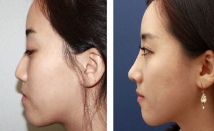 廈門整形醫(yī)院綜合評比，首屈一指的醫(yī)療機構(gòu)引領(lǐng)行業(yè)潮流