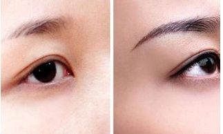 北京田永成醫(yī)美隆胸價(jià)格及術(shù)后效果解析