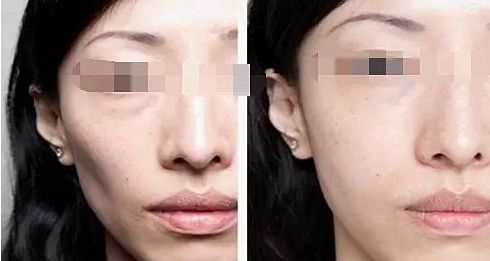 廈門整容醫(yī)院實力排名揭曉，輕松擁有美麗容顏！