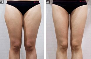 江蘇省人民醫(yī)院皮膚科醫(yī)生榮列榜單｜醫(yī)生個(gè)人背景資料詳解