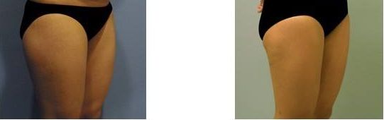 沈陽雙眼皮整形醫(yī)生哪位技術(shù)出眾？受歡迎的三位醫(yī)師推薦2023