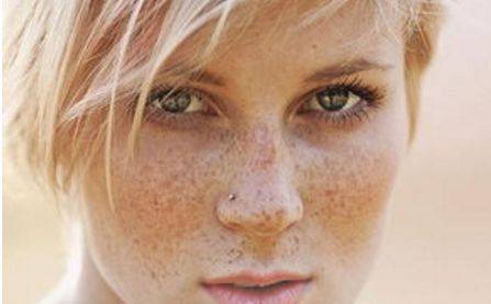 青州人民醫(yī)院美容科，了解一下主任介紹丨2023價格表丨激光祛痘案例排行