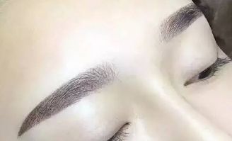 杜園園2023年雙眼皮修復(fù)案例揭秘，浦東區(qū)獨(dú)家經(jīng)驗(yàn)分享