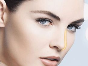 煙臺曹品根醫(yī)生的雙眼皮修復經(jīng)驗揭秘，90天修復案例全記錄