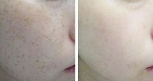 2023上海整容醫(yī)生榜單揭曉：韋敏、柴崗、林曉曦等榮登榜首