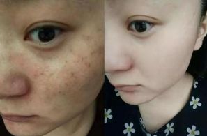 全國治療拉皮手術頗具實力的整形醫(yī)院公布：排名之選非他莫屬！