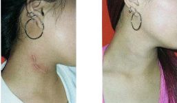 全國(guó)各大醫(yī)院推薦！拉皮手術(shù)高水平醫(yī)院盤(pán)點(diǎn)