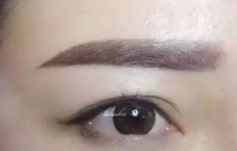 南昌美伊爾醫(yī)院的劉立軍醫(yī)生手術(shù)實(shí)力如何？擅長哪些手術(shù)？附真實(shí)案例為參考