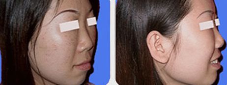 上海九院某醫(yī)生空前火爆！有幸親歷他的高超吸脂術(shù)！價格一覽來啦！