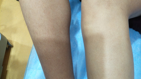 湘西自治州人民醫(yī)院燒傷美容整形科是否能滿足療效和口碑的雙重期望？有哪些備受推崇的醫(yī)生值得推薦？