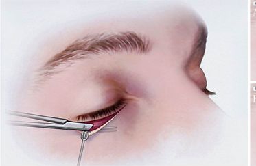 鼻部整形專家推薦：北京伊萊美哪位醫(yī)生技術(shù)一流？王冀耕、李旭東等好評如潮！