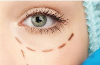 2023年首都北京近視手術(shù)醫(yī)生排行曝光！全面評(píng)估：口碑價(jià)位詳解，助你找到最佳矯正方案！