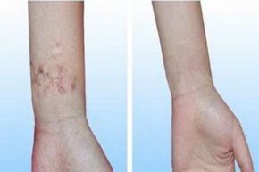 廣州地區(qū)口碑良好的植發(fā)醫(yī)院有哪些？就醫(yī)者推崇的醫(yī)院排名揭秘