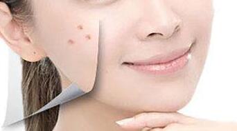 溫州醫(yī)科大學(xué)附屬第二醫(yī)院整形科除皺，技術(shù)型醫(yī)生和知識介紹怎么樣呢？