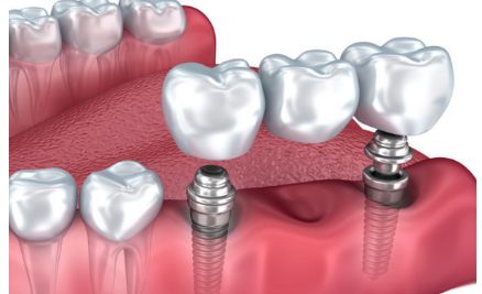 廣州華美高順福鼻修復(fù)帶來的革命性體驗(yàn)案例揭秘
