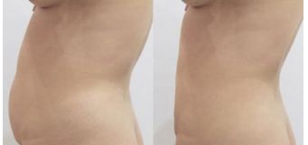 揭秘重慶美容整形醫(yī)院的最佳選擇，絕對讓您滿意！