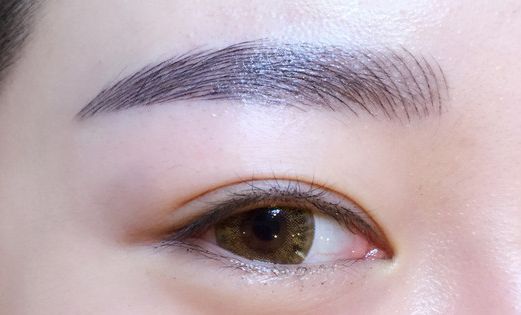 徐利剛：杭州藝星整形臨床實(shí)力派！鼻子整形解析，案例詳解！