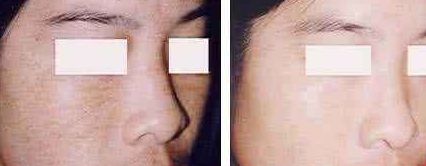 福州美貝爾醫(yī)療美容門診部：薛欣醫(yī)生用戶評價高？真實案例分享！