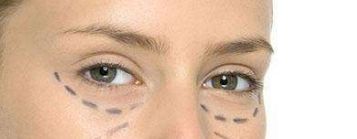 重慶德龍整形醫(yī)院推出先進(jìn)技術(shù)，助您實(shí)現(xiàn)完美雙眼皮!